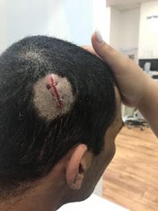 This is what lightly injured looks like.